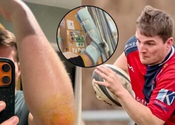 Adam Lang rugby player falling in dog poo during match: इंग्लैंड में टोनडू आरएफसी का एक खिलाड़ी कुत्ते की पॉटी पर फिसल गया, जिसके कारण उसे हॉस्पिटल में एडमिट कराना पड़ा.