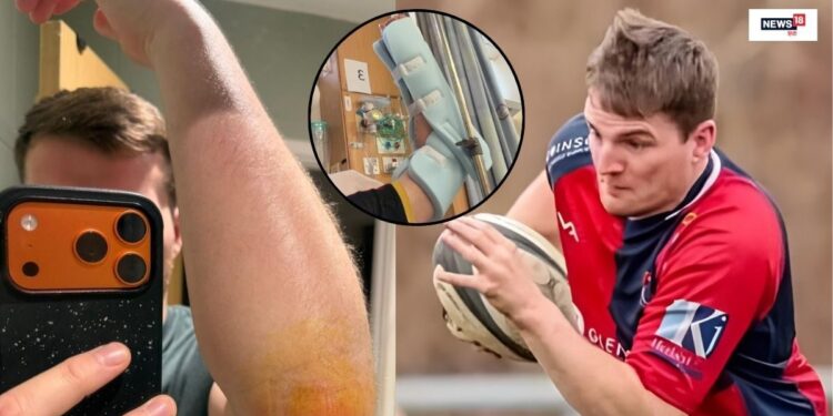 Adam Lang rugby player falling in dog poo during match: इंग्लैंड में टोनडू आरएफसी का एक खिलाड़ी कुत्ते की पॉटी पर फिसल गया, जिसके कारण उसे हॉस्पिटल में एडमिट कराना पड़ा.