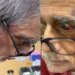 पद्मश्री प्रो. टीक लहरी को मारा थप्पड़, चोट के चलते आंख हुई लाल, पिछले 8 महीने से ICU में भर्ती