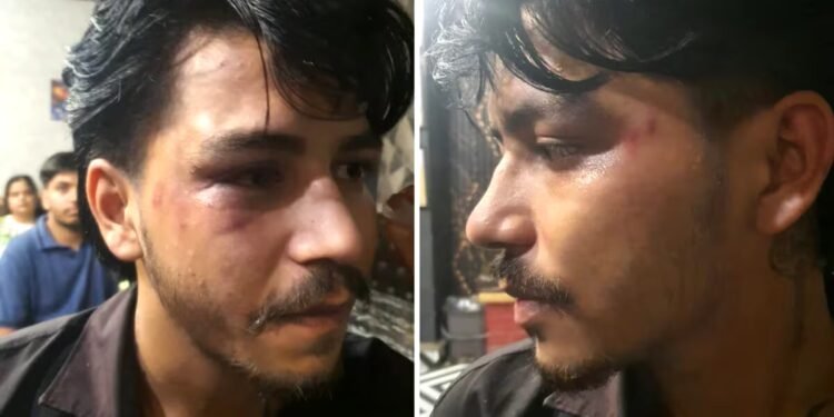 गाजियाबाद: राजेंद्र नगर के कैफे में बच्चे का बर्थडे मना रहे परिवार पर हमला, महिला से बदसलूकी और पति को पीटा