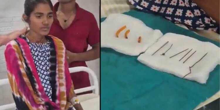 एक ऐसी बीमारी कि महिला खाने लगी अजीबोगरीब चीजें; पेट से मिले सुई, हेयर पिन और कांच